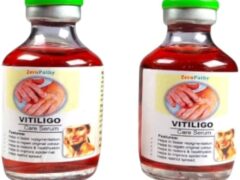 Vitiligo Miracle review ebook cover for natural vitiligo treatment